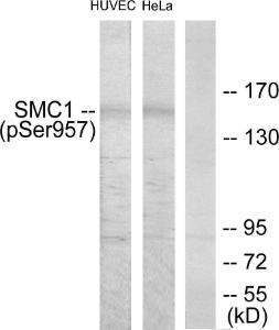 Western blot analysis of lysates from HUVEC cells treated with EGF 200ng/ml 5'/HeLa cells treated with EGF 200ng/ml 15' using Anti-SMC1 (phospho Ser957) Antibody. The right hand lane represents a negative control, where the antibody is blocked by the immunising peptide.