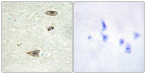 Immunohistochemical analysis of paraffin-embedded human brain tissue using Anti-GRK1 Antibody. The right hand panel represents a negative control, where the antibody was pre-incubated with the immunising peptide.