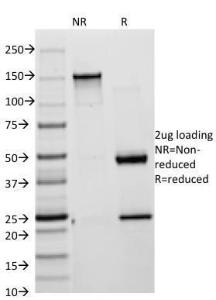 Anti-Cytokeratin 18 antibody