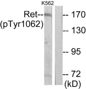 Anti-Ret Rabbit Polyclonal Antibody