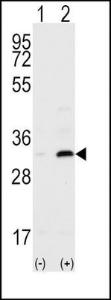 Anti-CD82 Rabbit Polyclonal Antibody (Biotin)