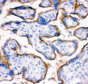 Anti-TFRC Polyclonal Antibody