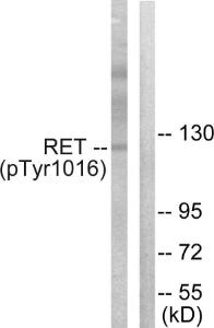 Western blot analysis of lysates from COS7 cells treated with EGF 200ng/ml 30' using Anti-Ret (phospho Tyr1015) Antibody. The right hand lane represents a negative control, where the antibody is blocked by the immunising peptide