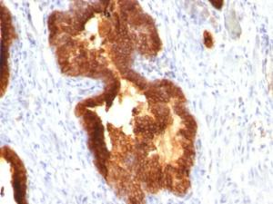 Anti-Cytokeratin 18 antibody