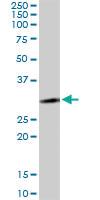 Anti-LYSMD2 Mouse Polyclonal Antibody