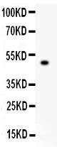 Anti-TJP1 Polyclonal Antibody