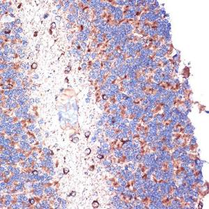 Immunohistochemistry analysis of paraffin-embedded rat brain using Anti-TTC11/FIS1 Antibody [ARC5010-01] (A307193) at a dilution of 1:100 (40X lens). Perform microwave antigen retrieval with 10 mM Tris/EDTA buffer pH 9.0 before commencing with IHC staining protocol