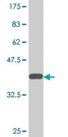 Anti-UBASH3A Mouse Monoclonal Antibody [clone: 4D2]