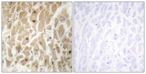 Immunohistochemical analysis of paraffin-embedded human heart tissue using Anti-FOXD3 Antibody. The right hand panel represents a negative control, where the Antibody was pre-incubated with the immunising peptide