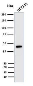 Anti-Cytokeratin 18 antibody