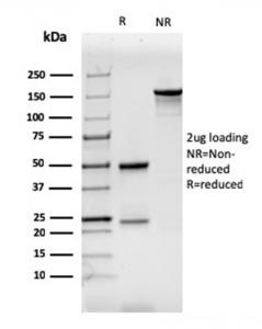 SDS-PAGE analysis of Anti-CD7 Antibody [CD7/3737] under non-reduced and reduced conditions; showing intact IgG and intact heavy and light chains, respectively SDS-PAGE analysis confirms the integrity and purity of the antibody