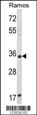 Anti-ACY3 Rabbit Polyclonal Antibody