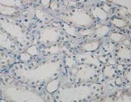 Anti-PAWR Rabbit Polyclonal Antibody