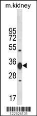 Anti-ACY3 Rabbit Polyclonal Antibody