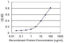 Anti-CLTC Mouse Monoclonal Antibody [clone: 2E5]