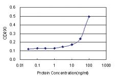 Anti-SRPK1 Antibody Pair