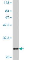 Anti-CLDN2 Mouse Polyclonal Antibody