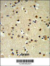 Anti-Heterochromatin Protein p25 Rabbit Polyclonal Antibody (HRP (Horseradish Peroxidase))