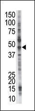 Anti-PSMD4 Rabbit Polyclonal Antibody (HRP (Horseradish Peroxidase))