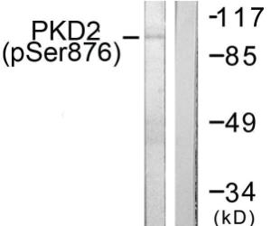 Western blot analysis of lysates from NIH/3T3 cells treated with PMA 250ng/ml 15' using Anti-PKD2 (phospho Ser876) Antibody. The right hand lane represents a negative control, where the antibody is blocked by the immunising peptide.