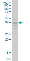 Anti-CCR2 Mouse Monoclonal Antibody [clone: 4D12]