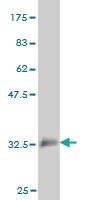 Anti-ELAVL4 Mouse Monoclonal Antibody [clone: 6B9]