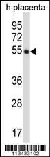 Anti-CRTRT1 Rabbit Polyclonal Antibody (HRP (Horseradish Peroxidase))