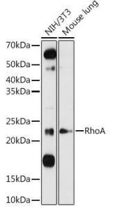 Western blot analysis of extracts of various cell lines, using Anti-RhoA Antibody (A12591) at 1:1000 dilution. The secondary Antibody was Goat Anti-Rabbit IgG H&L Antibody (HRP) at 1:10000 dilution. Lysates/proteins were present at 25 µg per lane