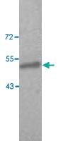 Anti-TPTE Rabbit Polyclonal Antibody