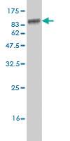 Anti-STK33 Mouse Monoclonal Antibody [clone: 6G1]