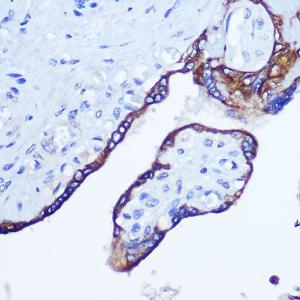 Immunohistochemistry analysis of paraffin-embedded human placenta using Anti-RhoA Antibody (A12591) at a dilution of 1:100 (40X lens). Perform microwave antigen retrieval with 10 mM Tris/EDTA buffer pH 9.0 before commencing with IHC staining protocol