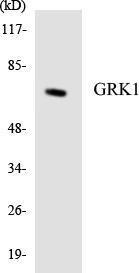 Western blot analysis of the lysates from Jurkat cells using Anti-GRK1 Antibody