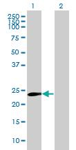 Anti-NOTCH2NL Mouse Polyclonal Antibody