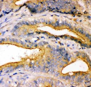 Anti-TJP1 Polyclonal Antibody