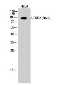 Western blot analysis of HELA cells using Anti-PKD2 (phospho Ser876) Antibody