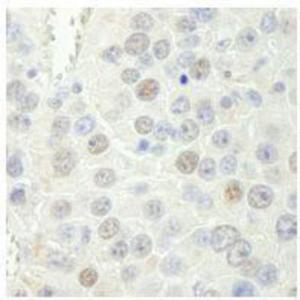 Anti-RTF1 Rabbit Polyclonal Antibody