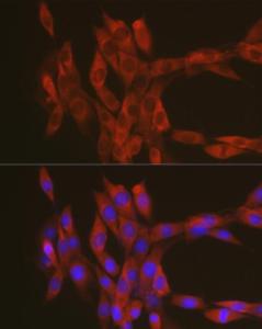 Immunofluorescence analysis of NIH-3T3 cells using Anti-RhoA Antibody (A12591) at a dilution of 1:100 (40X lens). DAPI was used to stain the cell nuclei (blue)