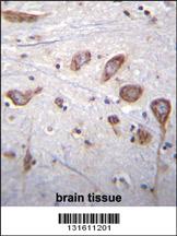 Anti-SP8 Rabbit Polyclonal Antibody