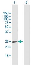 Anti-RAB31 Mouse Polyclonal Antibody