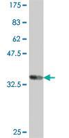 Anti-CNKSR1 Mouse Polyclonal Antibody