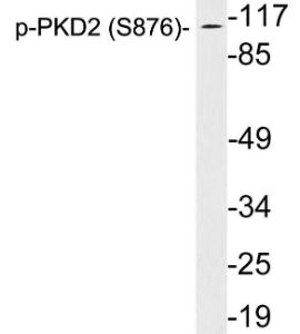 Anti-PKD2