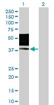 Anti-KIR2DL3 Rabbit Polyclonal Antibody