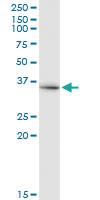 Anti-DCAF8 Mouse Monoclonal Antibody [clone: 4G8]