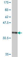 Anti-GNPAT Mouse Polyclonal Antibody