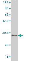 Anti-CLDN2 Mouse Monoclonal Antibody [clone: 3F1]