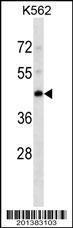 Anti-PDK4 Mouse Monoclonal Antibody (HRP (Horseradish Peroxidase)) [clone: 345CT19.6.2]