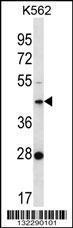 Anti-F105A Rabbit Polyclonal Antibody (AP (Alkaline Phosphatase))