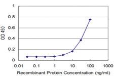 Anti-FOXF2 Mouse Monoclonal Antibody [clone: 4F8]