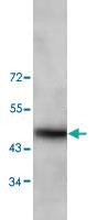 Anti-TRIM13 Rabbit Polyclonal Antibody