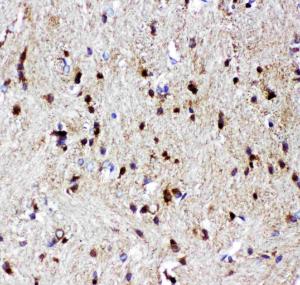 Anti-p73 Polyclonal Antibody